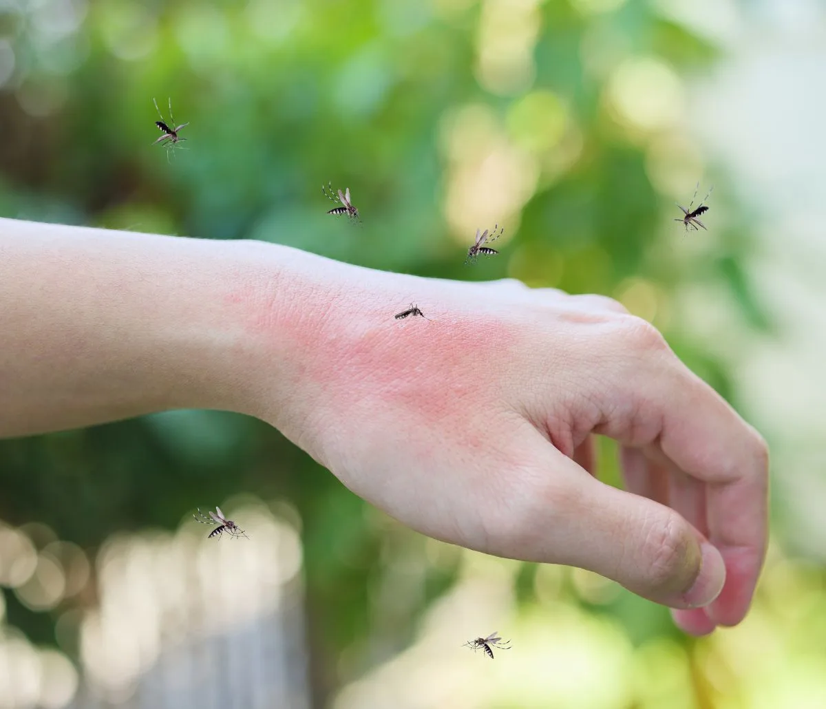 mosquito bites on hand